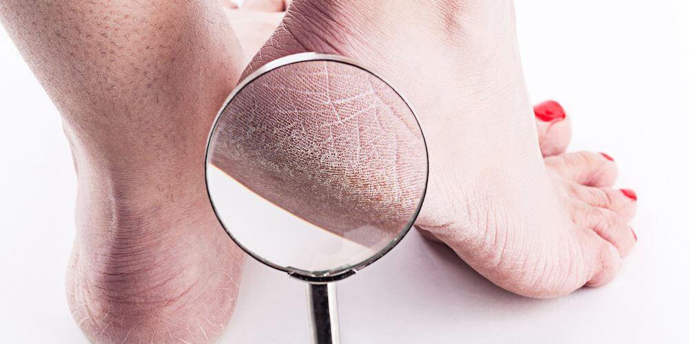 When to Seek Professional Help for Persistent Cracking